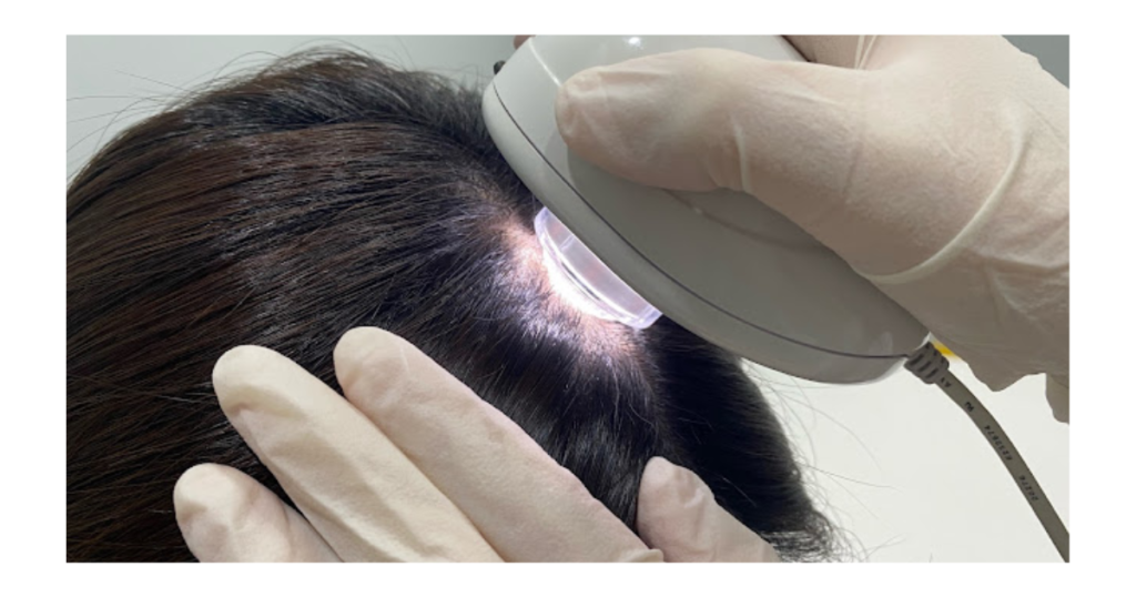 A dermatologist using a scalp diagnosing tool on their patient